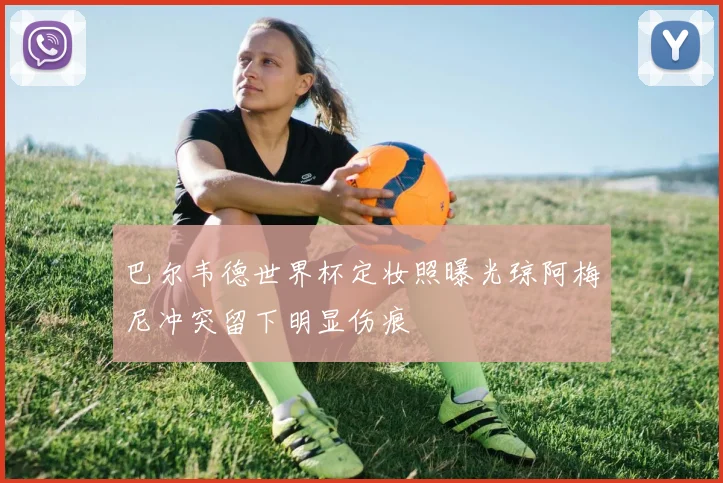 巴尔韦德世界杯定妆照曝光琼阿梅尼冲突留下明显伤痕